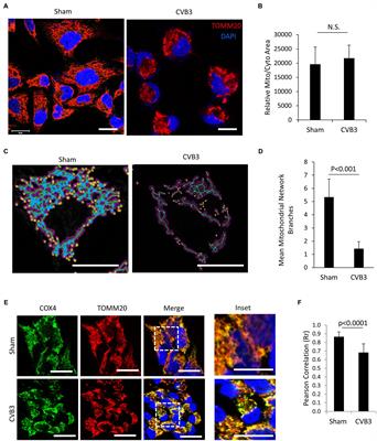 Autophagy Receptor Protein Tax1-Binding Protein 1/TRAF6-Binding Protein Is a Cellular Substrate of Enteroviral Proteinase